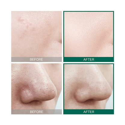 Some By Mi AHA. BHA. PHA 30 Days Miracle Toner