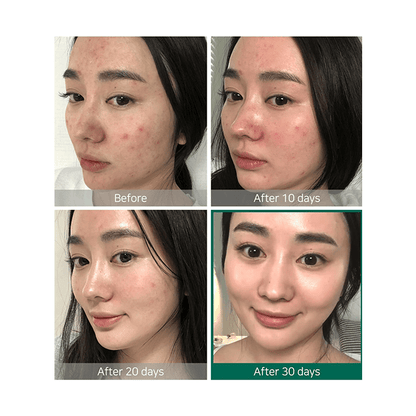 Some By Mi AHA. BHA. PHA 30 Days Miracle Toner