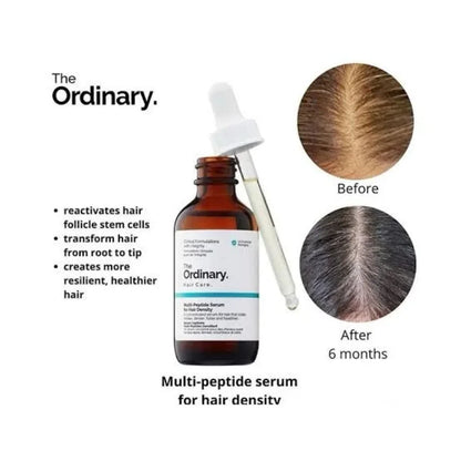 The ordinary BUY 1 GET 1 Free